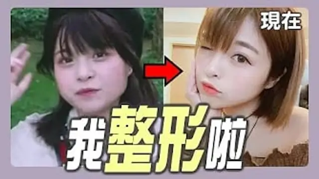 我整形啦～告別本壘板！(手術&恢復過程介紹)