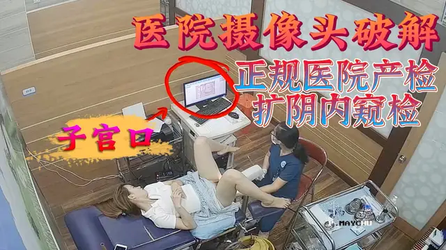 攝像頭破解-正規醫院產檢擴陰內窺檢